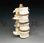 Budget Lumbar Vertebrae Sets